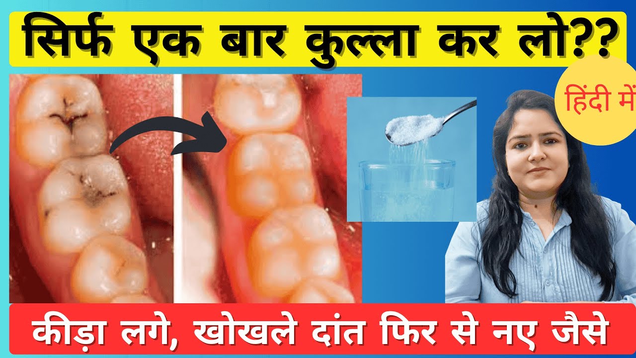 दांतों में दर्द और कीड़े का इलाज Treatment of tooth decay