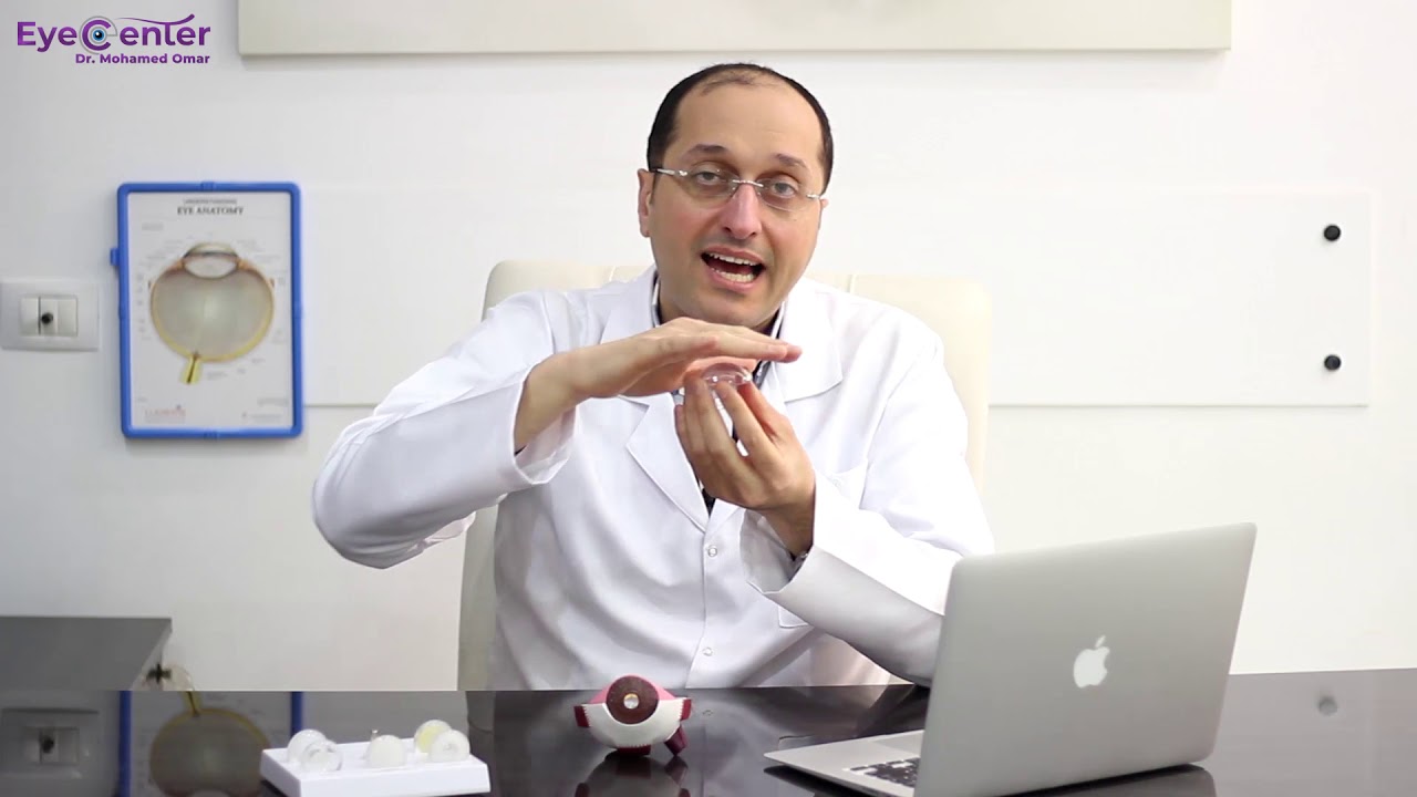 ما هو الليزر السطحي PRK - دكتور محمد عمر يوسف