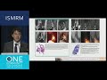 Ismrm 2019 plenary nibib new horizons lecture  machine learning from basics to the clinic