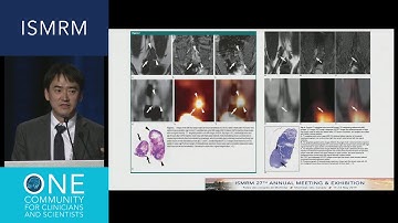 ISMRM 2019 Plenary: NIBIB New Horizons Lecture & "Machine Learning: From Basics to the Clinic"