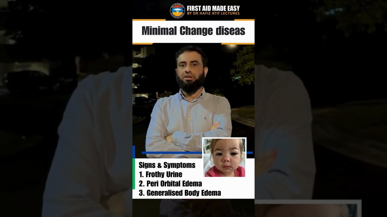 Minimal Change Disease | Nephrotic Syndrome | Dr.Hafiz Atif | First Aid Made Easy Platfrom