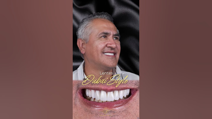 Luna González te ayuda a regalarle a Papá la mejor sonrisa. #DíaDelPadre #LunaGonzález #Odontología