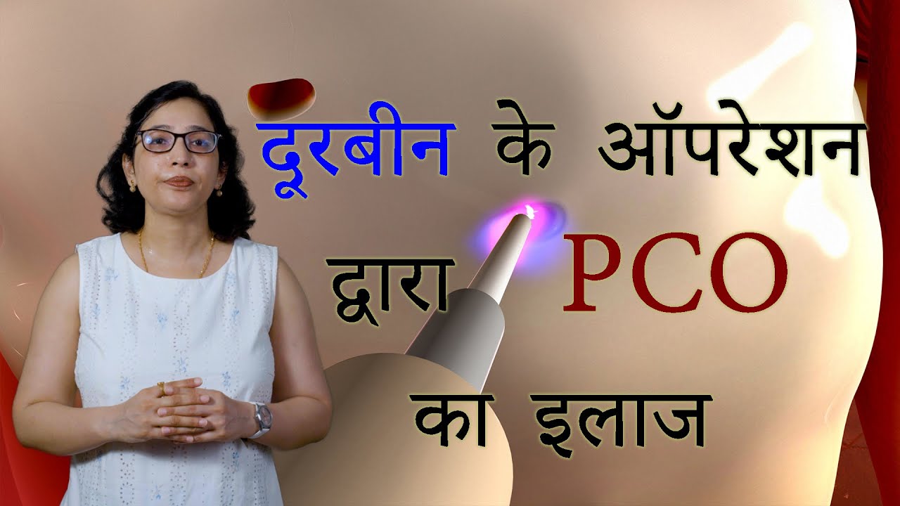 PCOD का इलाज : ऑपरेशन के द्वारा : Laparascopic Ovarian Drilling - YouTube