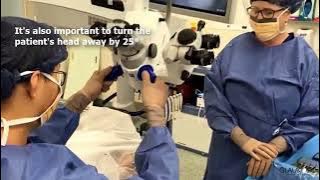 Tips & Pearls for iStent inject Implant