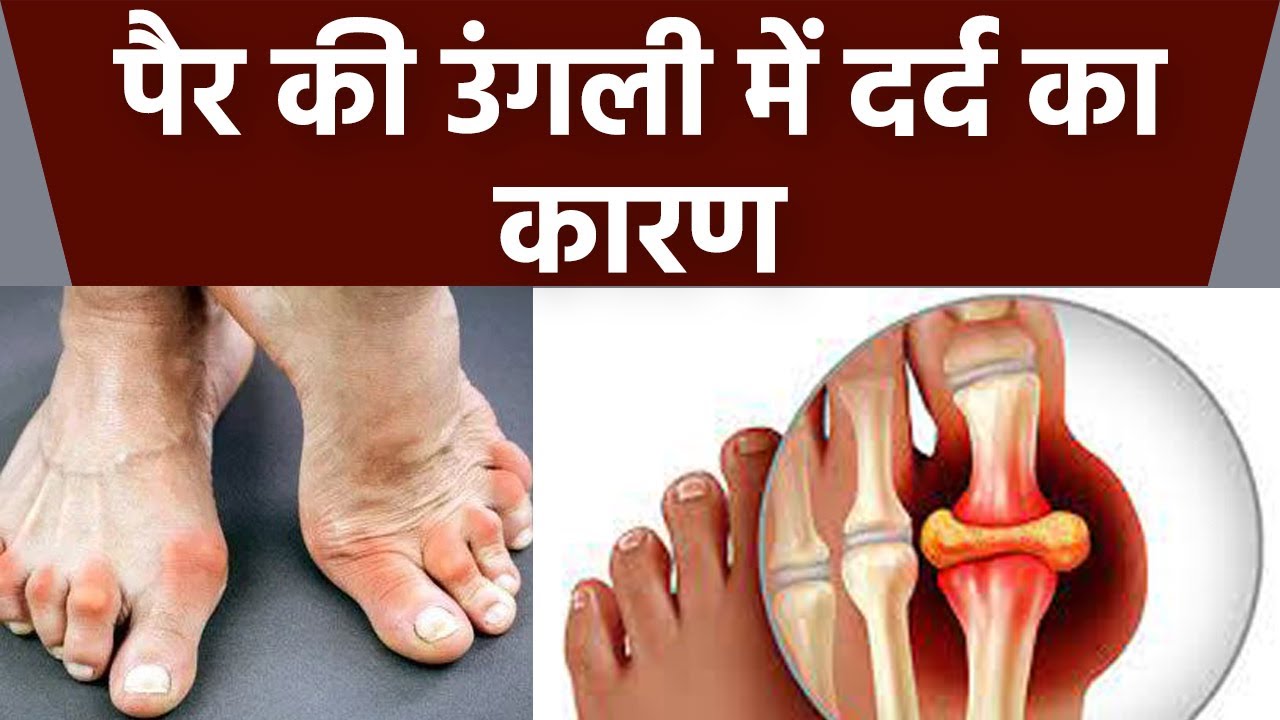 पैर की उंगली में दर्द का कारण Pair Ki Ungali me Dard ka karan Boldsky *Health YouTube