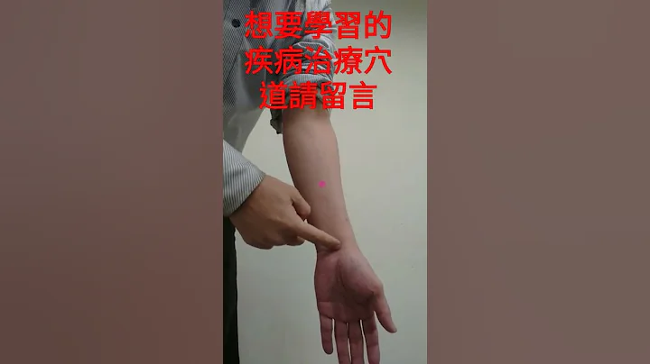 心絞痛 胸痛 心肌梗塞 呼吸困難 針灸按摩特效急救穴  郄門穴  Acupuncture - 天天要聞
