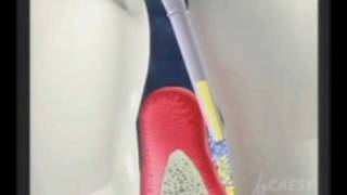 Gums |gingivitis | periodontal dentist | Eagle Rock |Dr. Sa