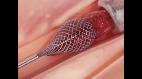 Doctors hope this revolutionary technology will help save millions of lives