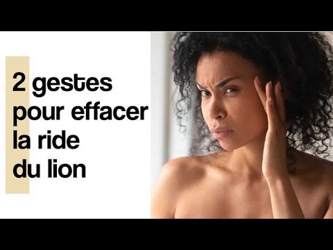 Vidéo: Comment Se Débarrasser Des Rides Du Lion: Remèdes Naturels Et Maison