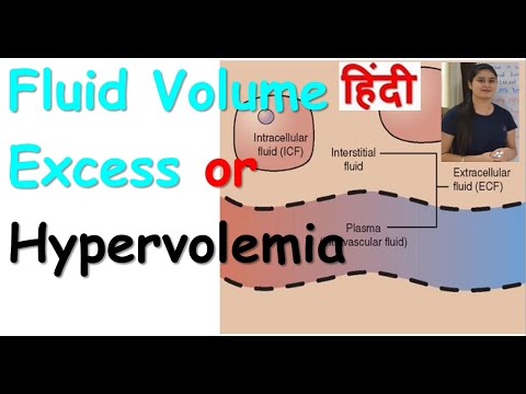 Fluid Volume Excess or Hypervolemia in Hindi | Causes | Pathophysiology | Clinical Manifestation