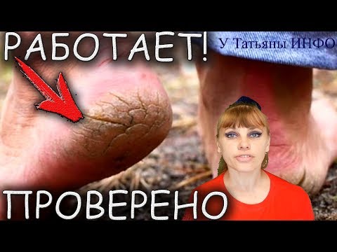 Сильнейший РЕЦЕПТ ОТ глубоких ТРЕЩИН на НОГАХ!