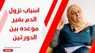 أسباب النزف /نزول الدم بغير موعد الدورة الشهرية