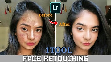 Face Retouching | Pimple Remove In Lightroom | In 2 Minutes | With Just One Tool |