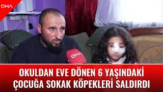 Eyüpsultanda Okuldan Eve Dönen 6 Yaşındaki Çocuğa Sokak Köpekleri Saldırdı