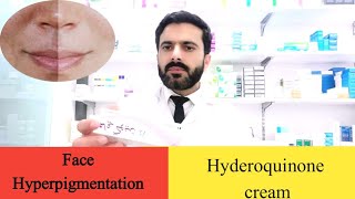 Hyderoquinone cream: uses and how to use it safely for Hyperpigmentation 