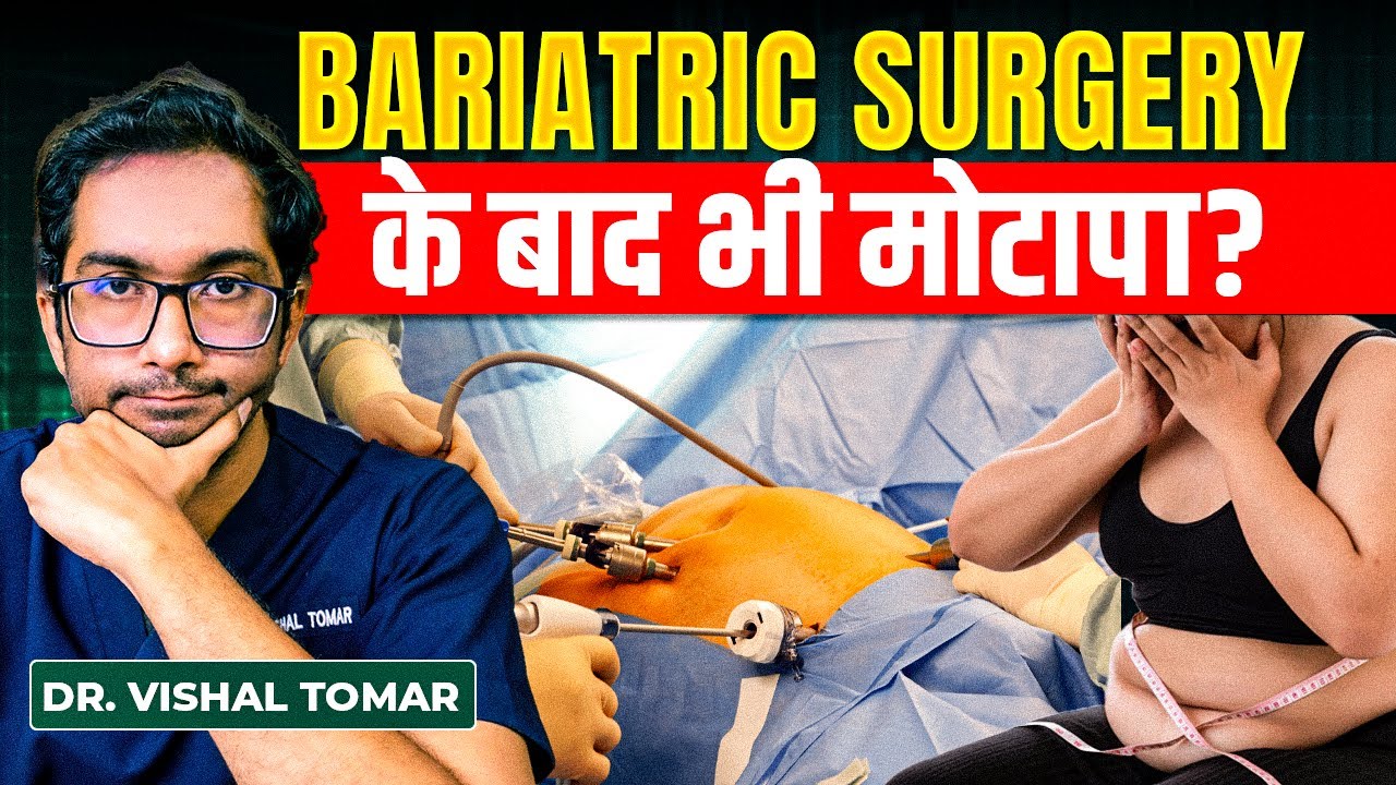 Life After Bariatric Surgery | क्या Weight दुबारा बढ़ेगा? | Bariatric ...
