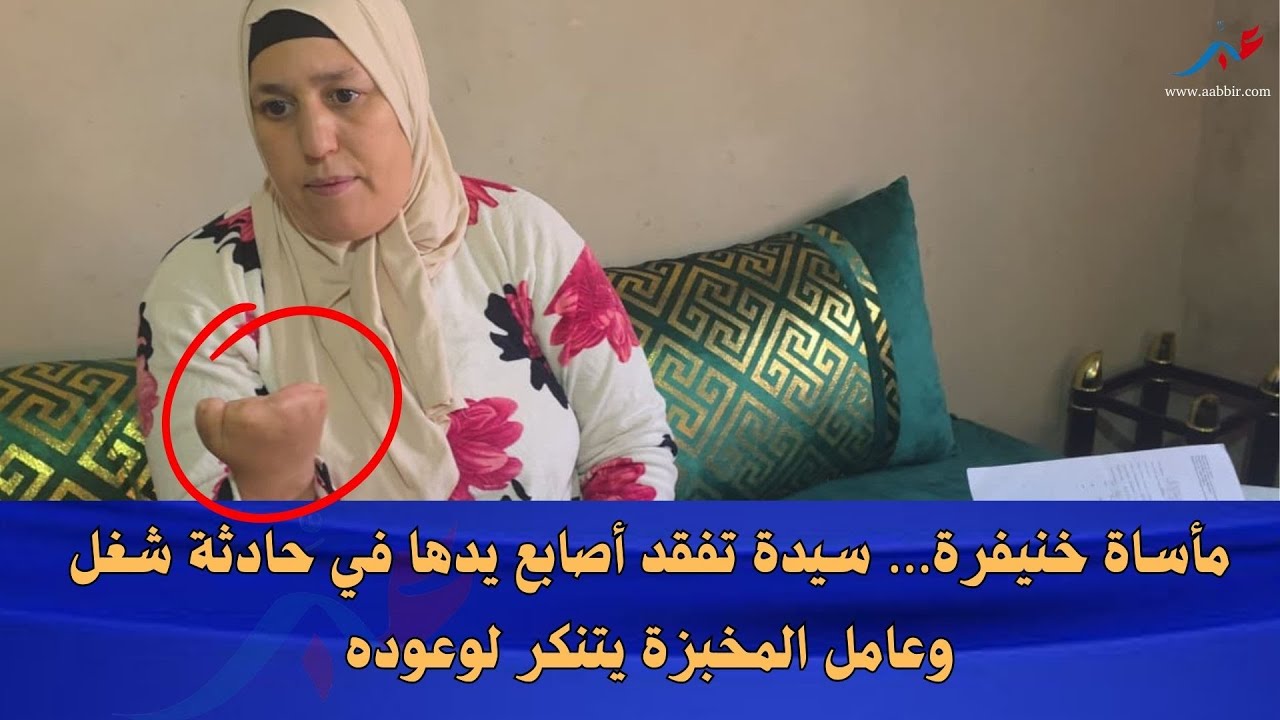مأساة خنيفرة… سيدة تفقد أصابع يدها في حادثة شغل وعامل المخبزة يتنكر لوعوده
