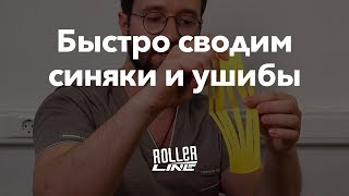 Как быстро избавиться от синяков | Школа роликов RollerLine Роллерлайн в Москве