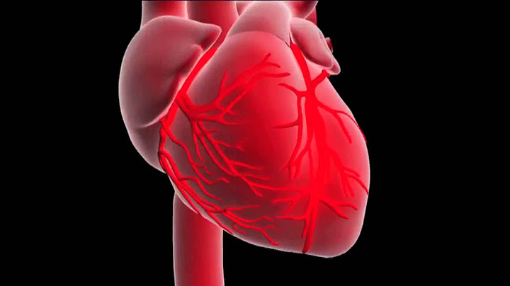 What is a myocardial infarction or heart attack ?