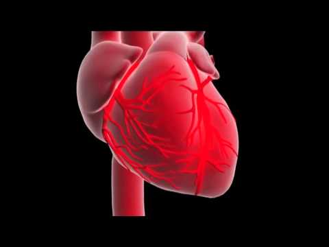 What is a myocardial infarction or heart attack ?