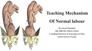 Mechanism of  Normal labour - Teaching Station for Part 3 MRCOG