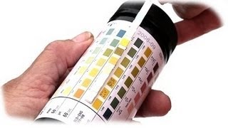 Urinalysis