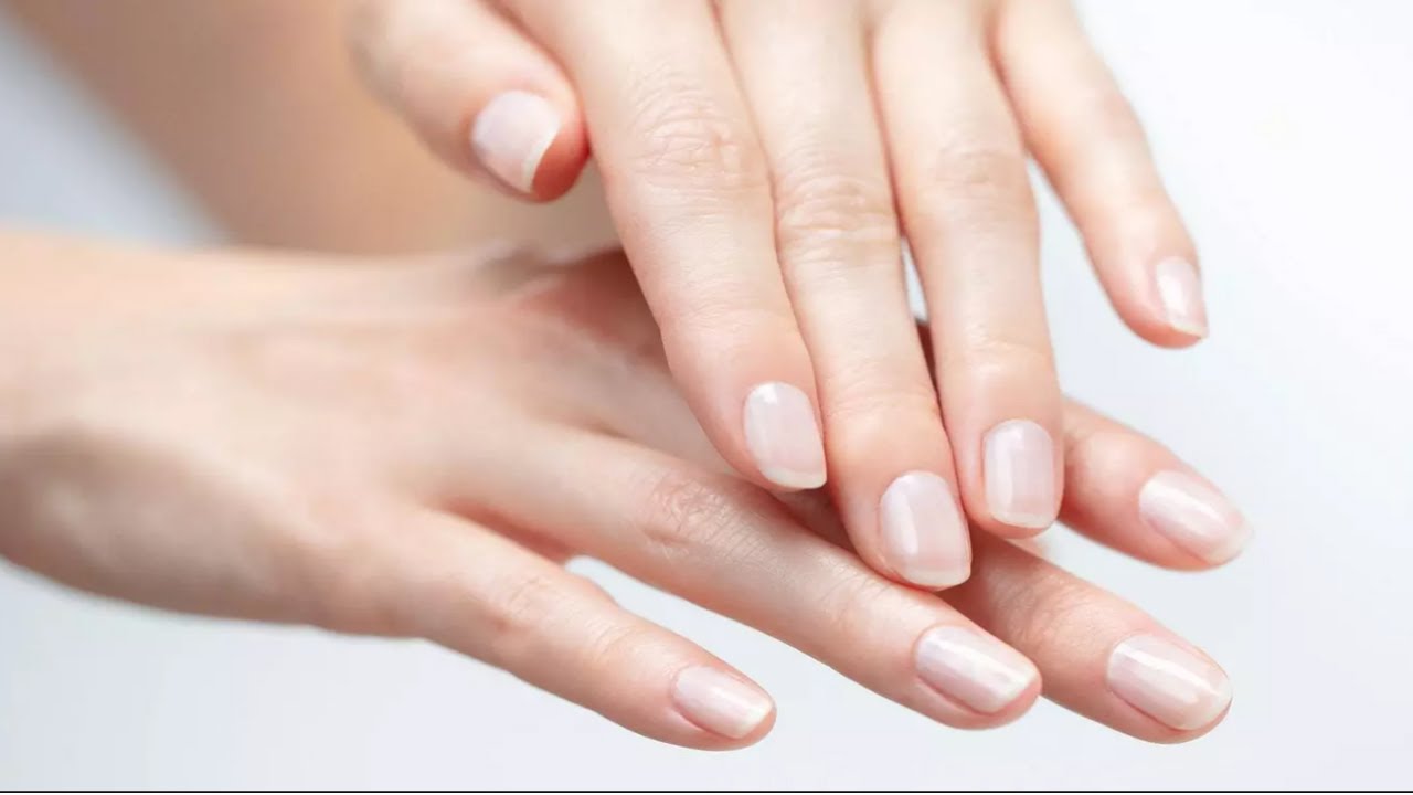 How to cure cracked skin YouTube