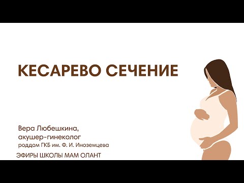 КЕСАРЕВО СЕЧЕНИЕ