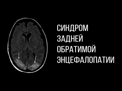 Видео: Синдром на Уенди: какво е това, как се проявява