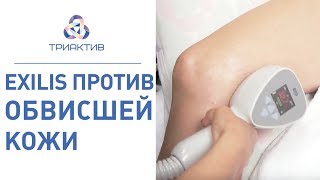 🔬Безоперационная подтяжка кожи тела с помощью процедуры EXILIS. Безоперационная подтяжка кожи. 12+