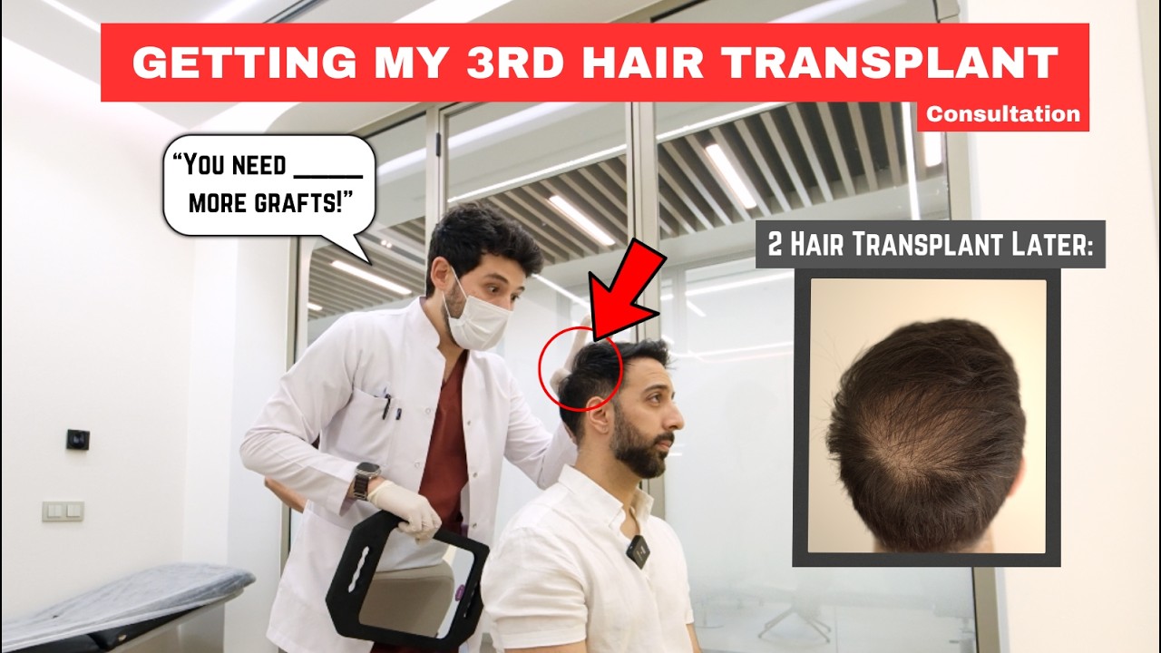 3rd Hair Transplant?! Here's What the Doctor Said…