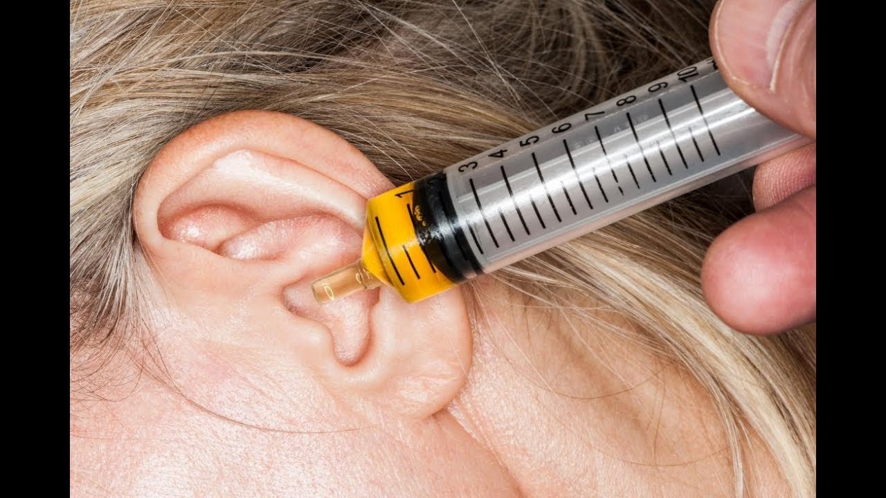 satisfying video remove ear wax and cleaning with song YouTube