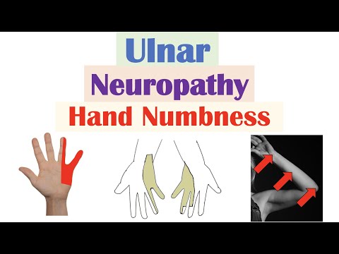 Video: Apa itu neuropati ulnaris?