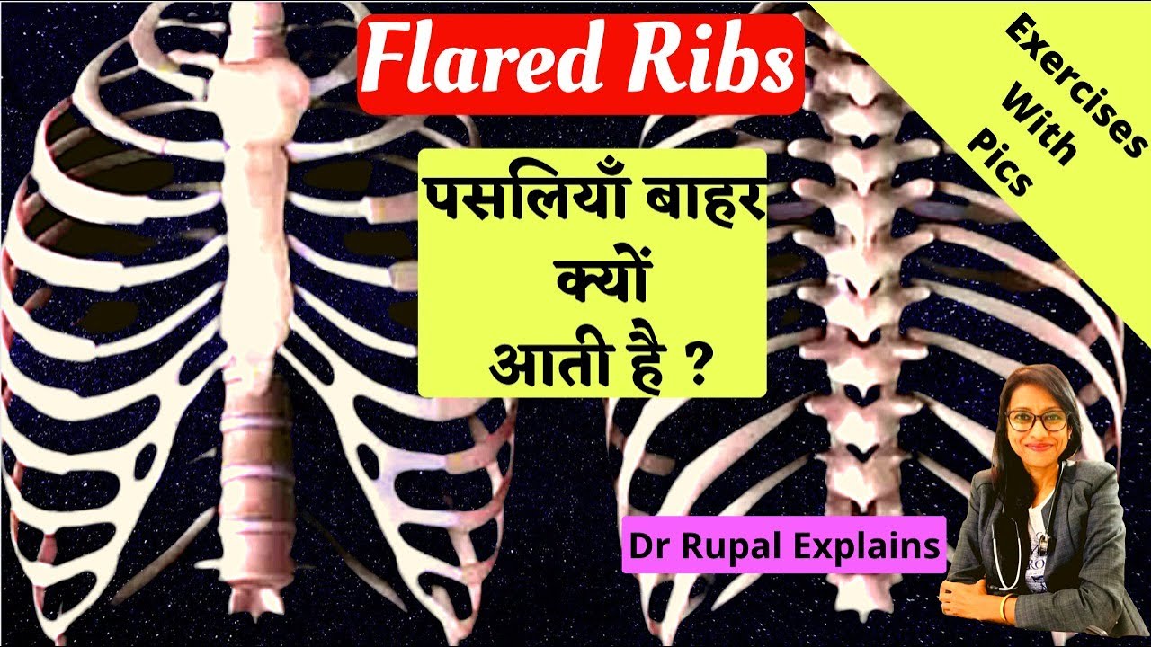Flared Ribs Top Exercises With PICS मेरी पसलियाँ बाहर आ रही है
