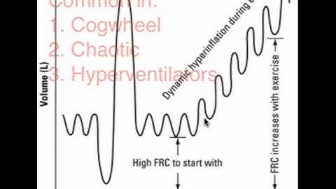 Dynamic Hyperinflation