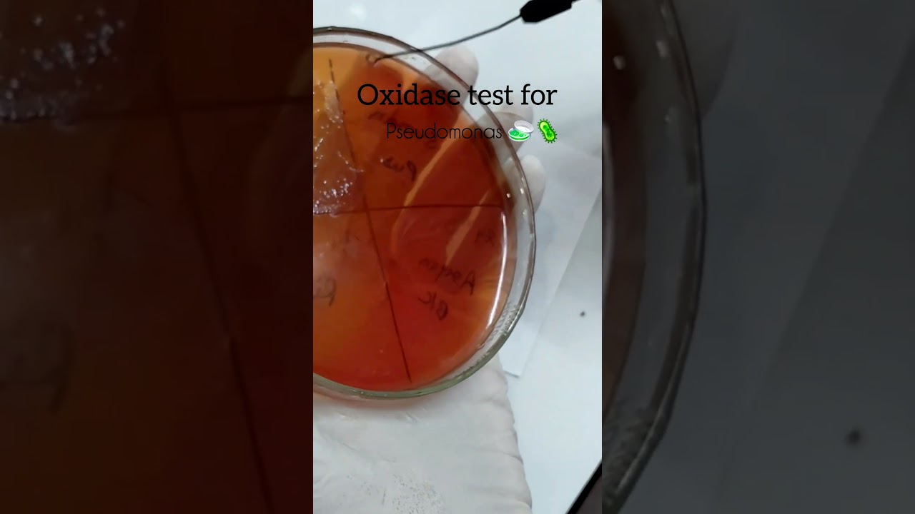 oxidase positive bacteria🦠 pseudomonas 