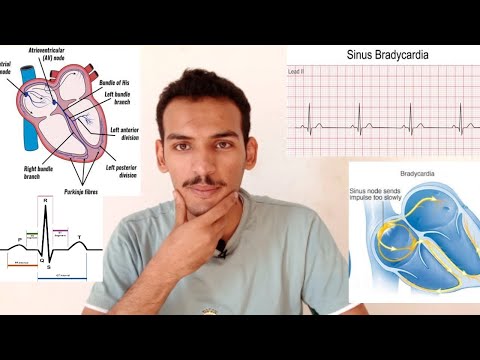 ج١ : حالات رسم القلب (sinus normal و Tachycardia و Bradycardia