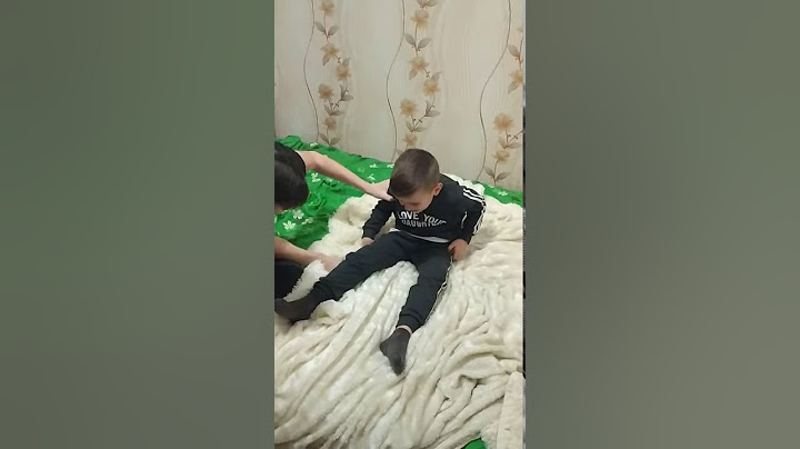 Жесть,Мальчик сломал руку!