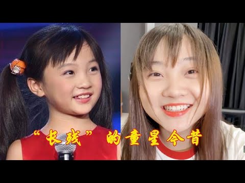 “长残”的童星今昔，阿尔法未老先秃，看到杨紫：是整容后遗症吗