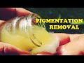 HOW TO GET RID OF PIGMENTATION ON FACE NATURALLY | TRY HOME REMEDIES FOR HYPERPIGMENTATION FACE