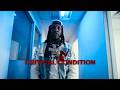 Lil Durk - Critical Condition (Music Video)