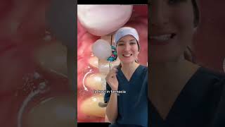 La cera ortodontica, cos’è e a cosa serve #dentista #dentist