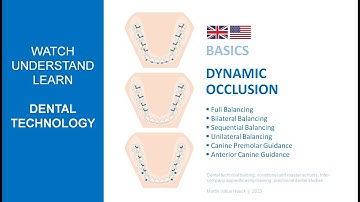Dynamic Occlusion Concepts [2023]   |  Basics