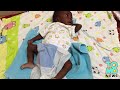 Baby na ipinanganak na may ekstrang paa't kamay, na-operahan na sa wakas!