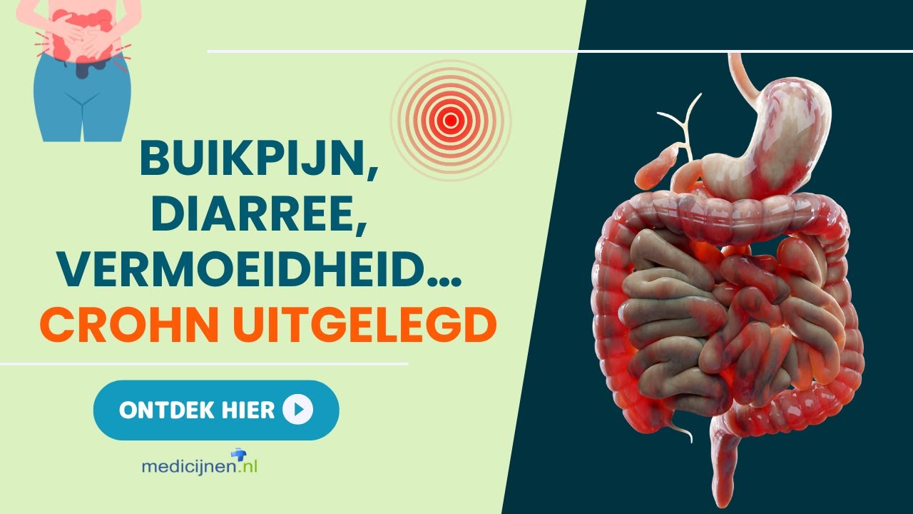 De ziekte van Crohn - YouTube