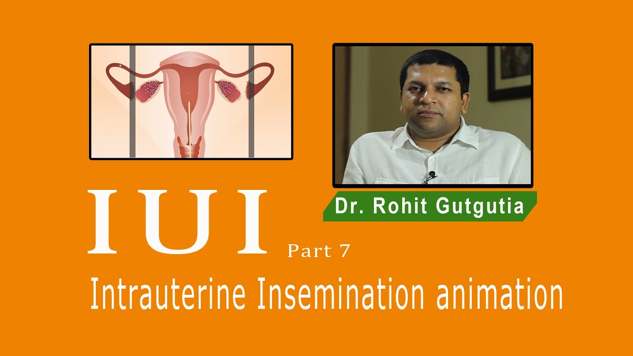 iui success rate