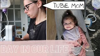 DAY IN MY LIFE WITH A TUBE FED BABY - Adjusting To Tube Feeding - Special Needs / Cerebral Palsy