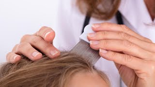 Lice prevention | Parent Squad