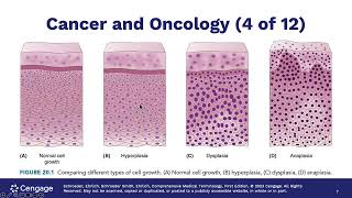 Chapter 20 Oncology Lecture Video