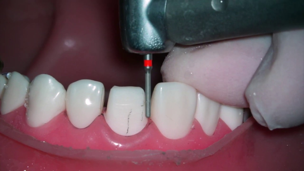 7 Fine adjustment YouTube